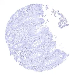 Anti-Prostatic Acid Phosphatase antibody [MSVA-452M] HistoMAX&trade; used in IHC (Paraffin sections) (IHC-P). GTX04396