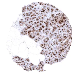 Anti-MUC1 antibody [MSVA-672R] HistoMAX&trade; used in IHC (Paraffin sections) (IHC-P). GTX04397