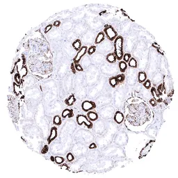 Anti-MUC1 antibody [MSVA-672R] HistoMAX&trade; used in IHC (Paraffin sections) (IHC-P). GTX04397