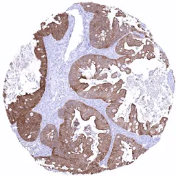 Anti-Villin antibody [MSVA-459R] HistoMAX&trade; used in IHC (Paraffin sections) (IHC-P). GTX04400
