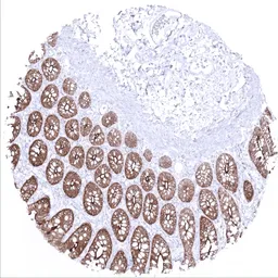 Anti-Villin antibody [MSVA-459R] HistoMAX&trade; used in IHC (Paraffin sections) (IHC-P). GTX04400