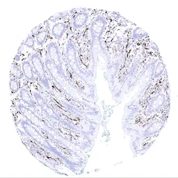 Anti-S100 beta antibody [MSVA-490R] HistoMAX&trade; used in IHC (Paraffin sections) (IHC-P). GTX04404