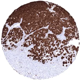 Anti-S100 beta antibody [MSVA-490R] HistoMAX&trade; used in IHC (Paraffin sections) (IHC-P). GTX04404