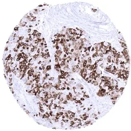 Anti-Mammaglobin A antibody [MSVA-457R] HistoMAX&trade; used in IHC (Paraffin sections) (IHC-P). GTX04406