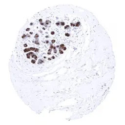 Anti-Mammaglobin A antibody [MSVA-457R] HistoMAX&trade; used in IHC (Paraffin sections) (IHC-P). GTX04406