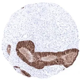 Anti-Mammaglobin A antibody [MSVA-457R] HistoMAX&trade; used in IHC (Paraffin sections) (IHC-P). GTX04406