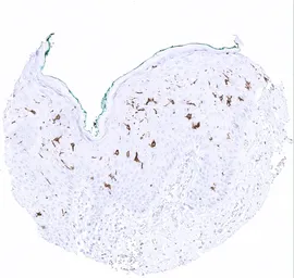 Anti-CD1a antibody [MSVA-001M] HistoMAX&trade; used in IHC (Paraffin sections) (IHC-P). GTX04407