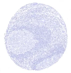 Anti-CD1a antibody [MSVA-001M] HistoMAX&trade; used in IHC (Paraffin sections) (IHC-P). GTX04407