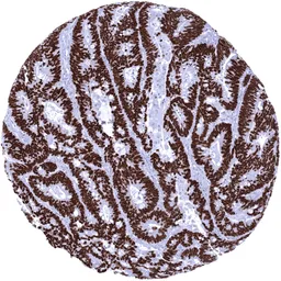 Anti-SATB2 antibody [MSVA-702R] HistoMAX&trade; used in IHC (Paraffin sections) (IHC-P). GTX04414