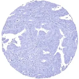 Anti-SATB2 antibody [MSVA-702R] HistoMAX&trade; used in IHC (Paraffin sections) (IHC-P). GTX04414