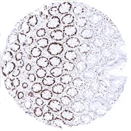 Anti-MSH6 antibody [MSVA-906R] HistoMAX&trade; used in IHC (Paraffin sections) (IHC-P). GTX04416