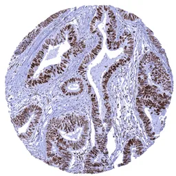 Anti-MSH6 antibody [MSVA-906R] HistoMAX&trade; used in IHC (Paraffin sections) (IHC-P). GTX04416