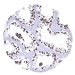 Anti-Topoisomerase II alpha antibody [MSVA-802R] HistoMAX&trade; used in IHC (Paraffin sections) (IHC-P). GTX04422
