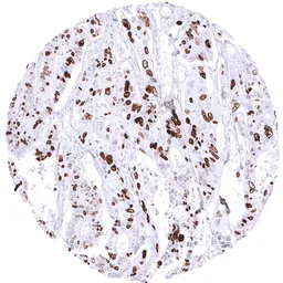 Anti-Topoisomerase II alpha antibody [MSVA-802R] HistoMAX&trade; used in IHC (Paraffin sections) (IHC-P). GTX04422