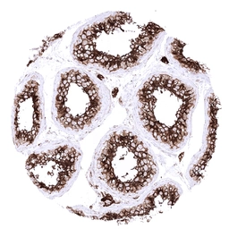 Anti-ACE2 antibody [MSVA-919R] HistoMAX&trade; used in IHC (Paraffin sections) (IHC-P). GTX04425