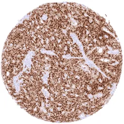 Anti-PAX8 antibody [MSVA-708R] HistoMAX&trade; used in IHC (Paraffin sections) (IHC-P). GTX04430
