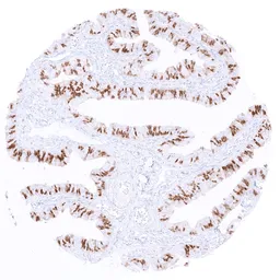 Anti-PAX8 antibody [MSVA-708R] HistoMAX&trade; used in IHC (Paraffin sections) (IHC-P). GTX04430