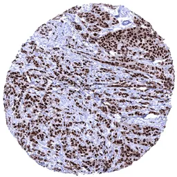 Anti-Progesterone Receptor antibody [MSVA-570R] HistoMAX&trade; used in IHC (Paraffin sections) (IHC-P). GTX04431