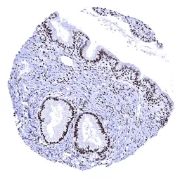 Anti-Progesterone Receptor antibody [MSVA-570R] HistoMAX&trade; used in IHC (Paraffin sections) (IHC-P). GTX04431