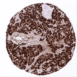 Anti-CPA1 antibody [MSVA-601M] HistoMAX&trade; used in IHC (Paraffin sections) (IHC-P). GTX04433