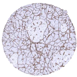 Anti-Collagen IV antibody [MSVA-704R] HistoMAX&trade; used in IHC (Paraffin sections) (IHC-P). GTX04434