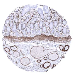 Anti-Collagen IV antibody [MSVA-704R] HistoMAX&trade; used in IHC (Paraffin sections) (IHC-P). GTX04434