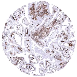 Anti-Collagen IV antibody [MSVA-704R] HistoMAX&trade; used in IHC (Paraffin sections) (IHC-P). GTX04434
