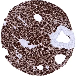 Anti-GP2 antibody [MSVA-475M] HistoMAX&trade; used in IHC (Paraffin sections) (IHC-P). GTX04436