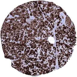 Anti-Elastase 3B antibody [MSVA-410M] HistoMAX&trade; used in IHC (Paraffin sections) (IHC-P). GTX04445