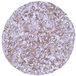 Anti-Factor XIIIa antibody [MSVA-813R] HistoMAX&trade; used in IHC (Paraffin sections) (IHC-P). GTX04452