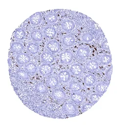 Anti-Factor XIIIa antibody [MSVA-813R] HistoMAX&trade; used in IHC (Paraffin sections) (IHC-P). GTX04452