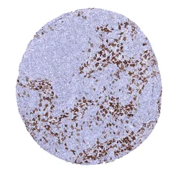 Anti-Factor XIIIa antibody [MSVA-813R] HistoMAX&trade; used in IHC (Paraffin sections) (IHC-P). GTX04452