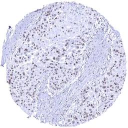 Anti-Nucleolin antibody [MSVA-623R] HistoMAX&trade; used in IHC (Paraffin sections) (IHC-P). GTX04456