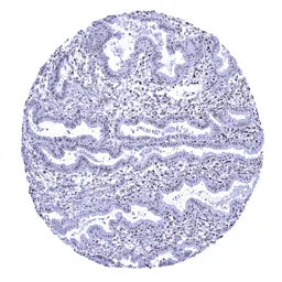 Anti-Nucleolin antibody [MSVA-623R] HistoMAX&trade; used in IHC (Paraffin sections) (IHC-P). GTX04456
