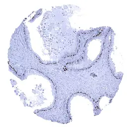 Anti-p63 antibody [MSVA-063R] HistoMAX&trade; used in IHC (Paraffin sections) (IHC-P). GTX04458