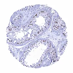Anti-SOX9 antibody [MSVA-709R] HistoMAX&trade; used in IHC (Paraffin sections) (IHC-P). GTX04459