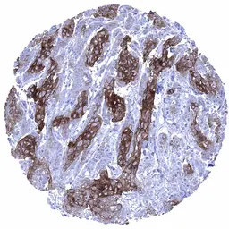 Anti-Desmoglein 1 antibody [MSVA-544M] HistoMAX&trade; used in IHC (Paraffin sections) (IHC-P). GTX04464