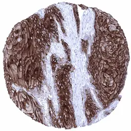 Anti-Desmoglein 1 antibody [MSVA-544M] HistoMAX&trade; used in IHC (Paraffin sections) (IHC-P). GTX04464