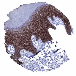 Anti-Desmoglein 1 antibody [MSVA-544M] HistoMAX&trade; used in IHC (Paraffin sections) (IHC-P). GTX04464