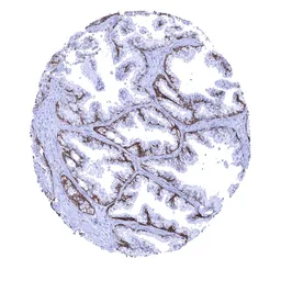 Anti-TRIM29 antibody [MSVA-629M] HistoMAX&trade; used in IHC (Paraffin sections) (IHC-P). GTX04467