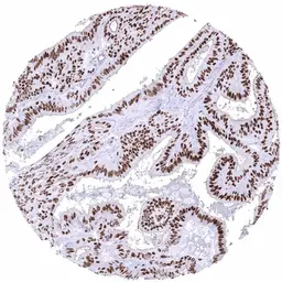Anti-Estrogen Receptor alpha antibody [MSVA-564R] HistoMAX&trade; used in IHC (Paraffin sections) (IHC-P). GTX04474