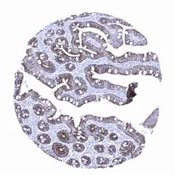 Anti-Hepatocyte Specific Antigen antibody [MSVA-OCE5] HistoMAX&trade; used in IHC (Paraffin sections) (IHC-P). GTX04478