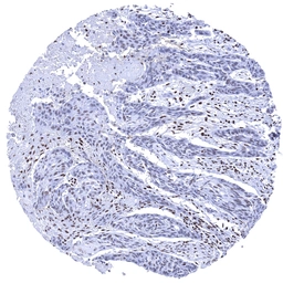 Anti-Ku80 antibody [MSVA-880M] HistoMAX&trade; used in IHC (Paraffin sections) (IHC-P). GTX04480
