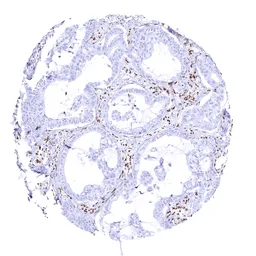 Anti-BRG1 antibody [MSVA-397R] HistoMAX&trade; used in IHC (Paraffin sections) (IHC-P). GTX04486