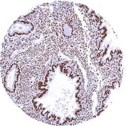 Anti-BRG1 antibody [MSVA-397R] HistoMAX&trade; used in IHC (Paraffin sections) (IHC-P). GTX04486
