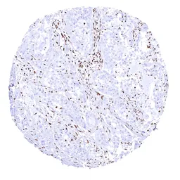 Anti-BRG1 antibody [MSVA-397R] HistoMAX&trade; used in IHC (Paraffin sections) (IHC-P). GTX04486