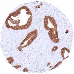 Anti-TFF1 antibody [MSVA-482M] HistoMAX&trade; used in IHC (Paraffin sections) (IHC-P). GTX04488