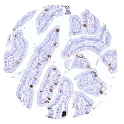 Anti-TFF1 antibody [MSVA-482M] HistoMAX&trade; used in IHC (Paraffin sections) (IHC-P). GTX04488