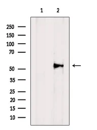 Anti-Vimentin antibody used in Western Blot (WB). GTX04497