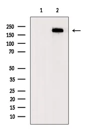 Anti-Fibronectin antibody used in Western Blot (WB). GTX04498